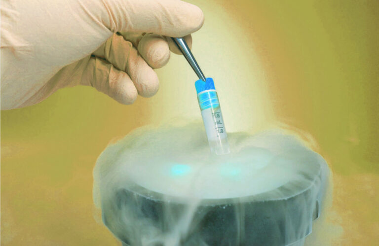 5 Key Factors To Consider Before Undergoing Egg Freezing